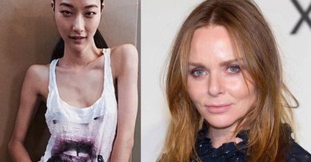 Stella McCartney też promuje anoreksję? "Ta kobieta jest chora! TO WISZĄCE KOŚCI!"