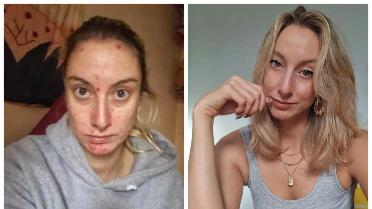 Abi Feltham pokonała nałóg i dziś pomaga innym walczyć z chorobą 