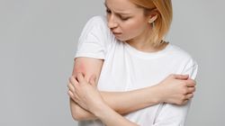 Zespół Sézary'ego - przyczyny, objawy, diagnostyka, leczenie