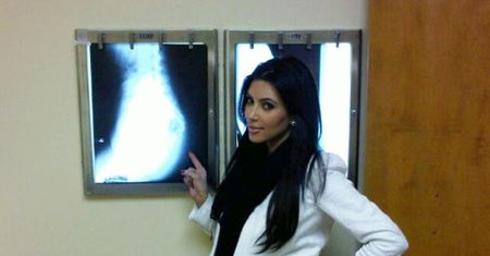 Kardashian prześwietliła sobie tyłek! (FOTO)