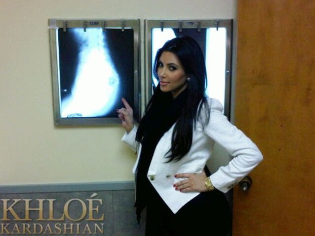 Kardashian prześwietliła sobie tyłek! (FOTO)