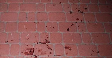 Po wypadku 6-latek uciekł. Policjanta naprowadziły ślady krwi