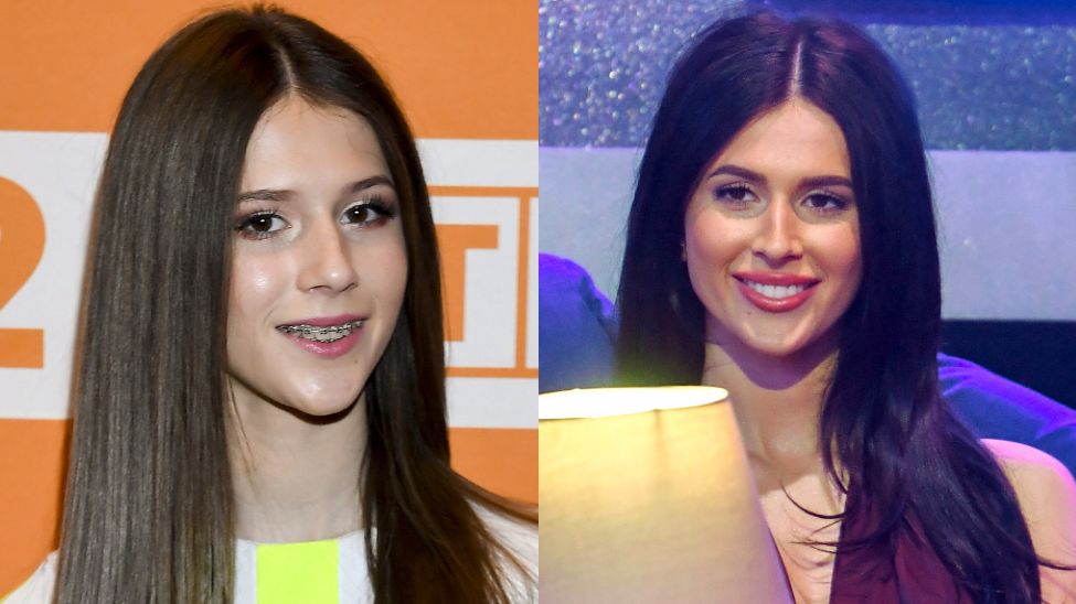 Roksana Węgiel o naturalnym uśmiechu i powiększeniu ust