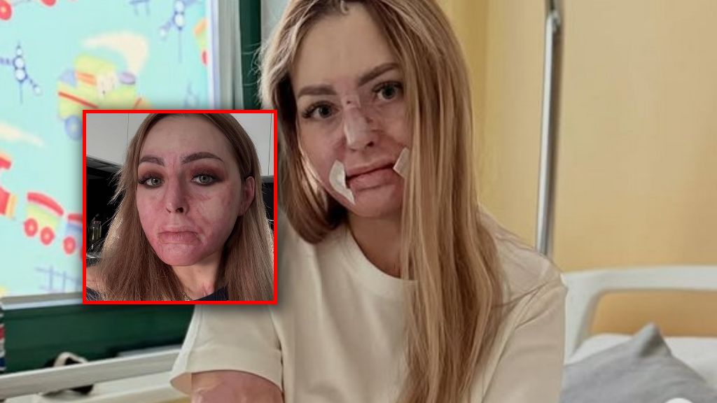 Maja Kuczyńska po operacji