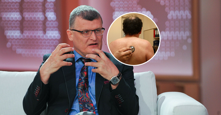 Co trzeci jest nosicielem. "Choroba wraca z dużym nasileniem"