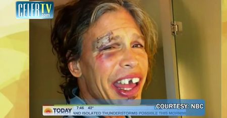 Steven Tyler BEZ ZĘBA!