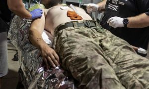 Sekcji zwłok ukraińskiego żołnierza. Szokujące odkrycie w ciele