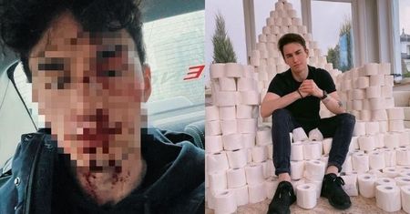 Marcin Dubiel pokazał ZAKRWAWIONĄ TWARZ: "Niech ten dzień się skończy" (FOTO)