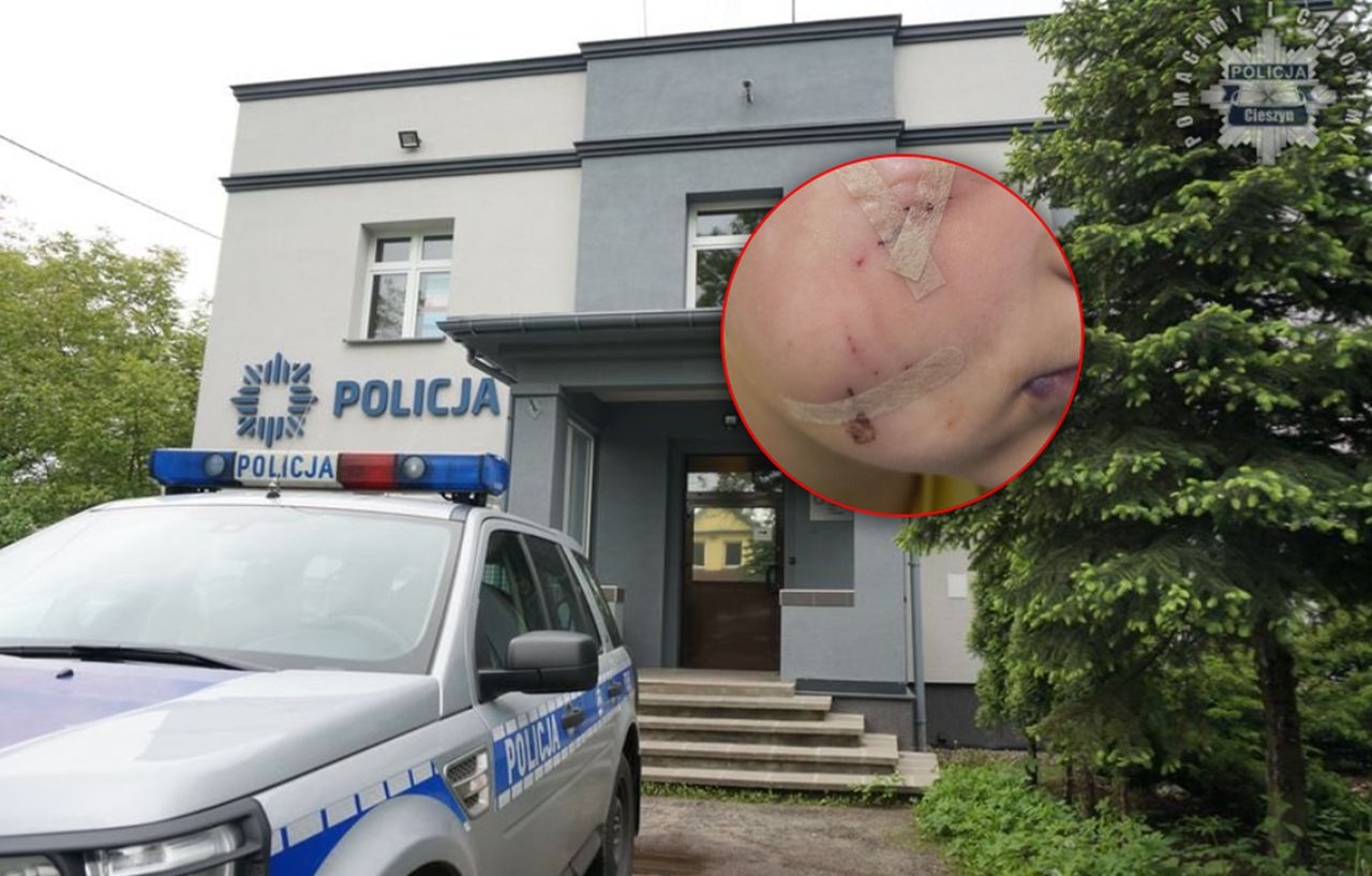 Pies rzucił się na dziecko. Jego właściciel usłyszał zarzuty