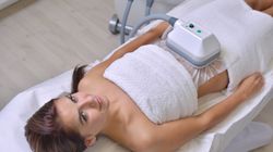 Kriolipoliza - wskazania, przebieg zabiegu, przeciwwskazania, powikłania, cena