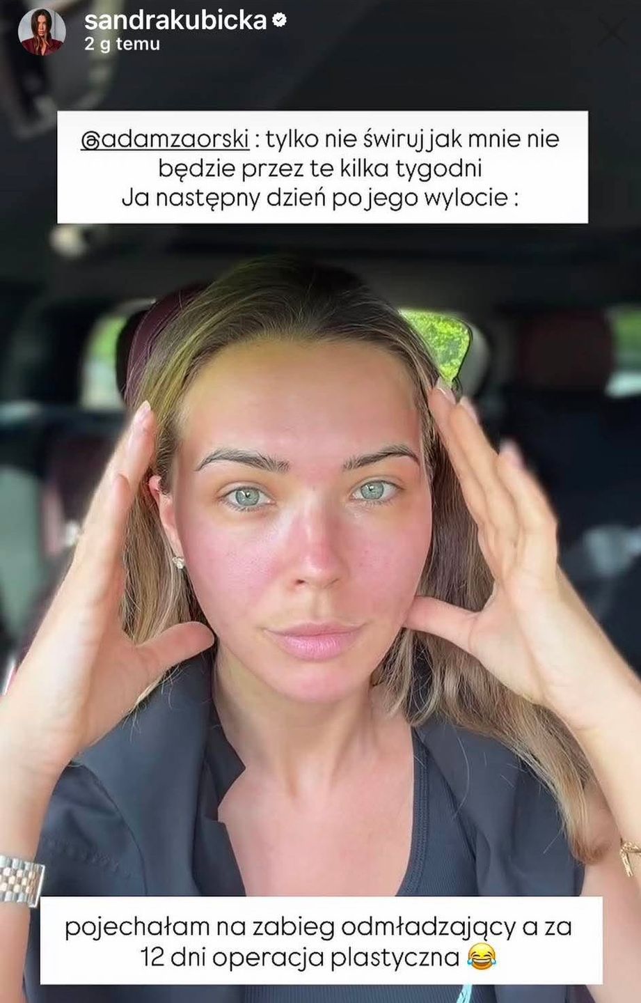 Sandra Kubicka podda się operacji plastycznej. Oto co zoperuje