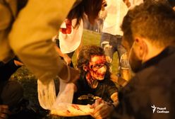 Ranni na ulicach Białorusi. Szokujące zdjęcia