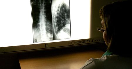 Światowej sławy radiolodzy przyjadą do Łodzi na dwudniowy "kominek". Będą omawiać najtrudniejsze przypadki