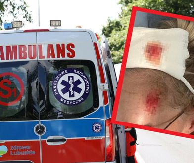 Potrącił kobietę i uciekł. "Zostawiłeś mnie nieprzytomną"