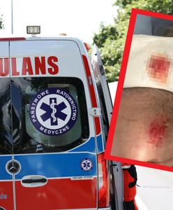 Potrącił kobietę i uciekł. "Zostawiłeś mnie nieprzytomną"