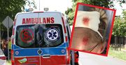 Potrącił kobietę i uciekł. "Zostawiłeś mnie nieprzytomną"