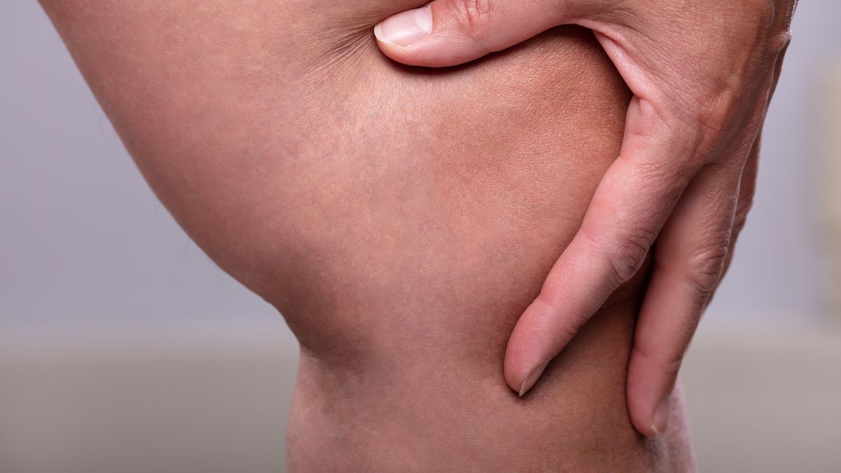 Zakrzepica może być objawem raka trzustki