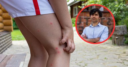 Wirus chikungunya jest w Polsce. Ekspert mówi, jakie daje objawy