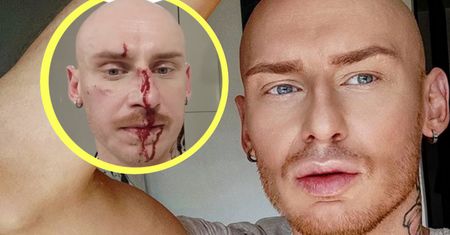 Jacek Szawioła wraca do żywych. Tydzień temu został brutalnie pobity