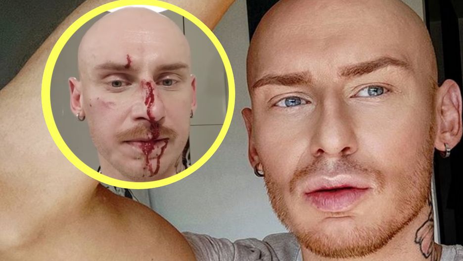 Jacek Szawioła wraca do żywych. Tydzień temu został brutalnie pobity