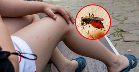 Zagadka rozwiązana. To dlatego komary jednego gryzą, drugiego nie
