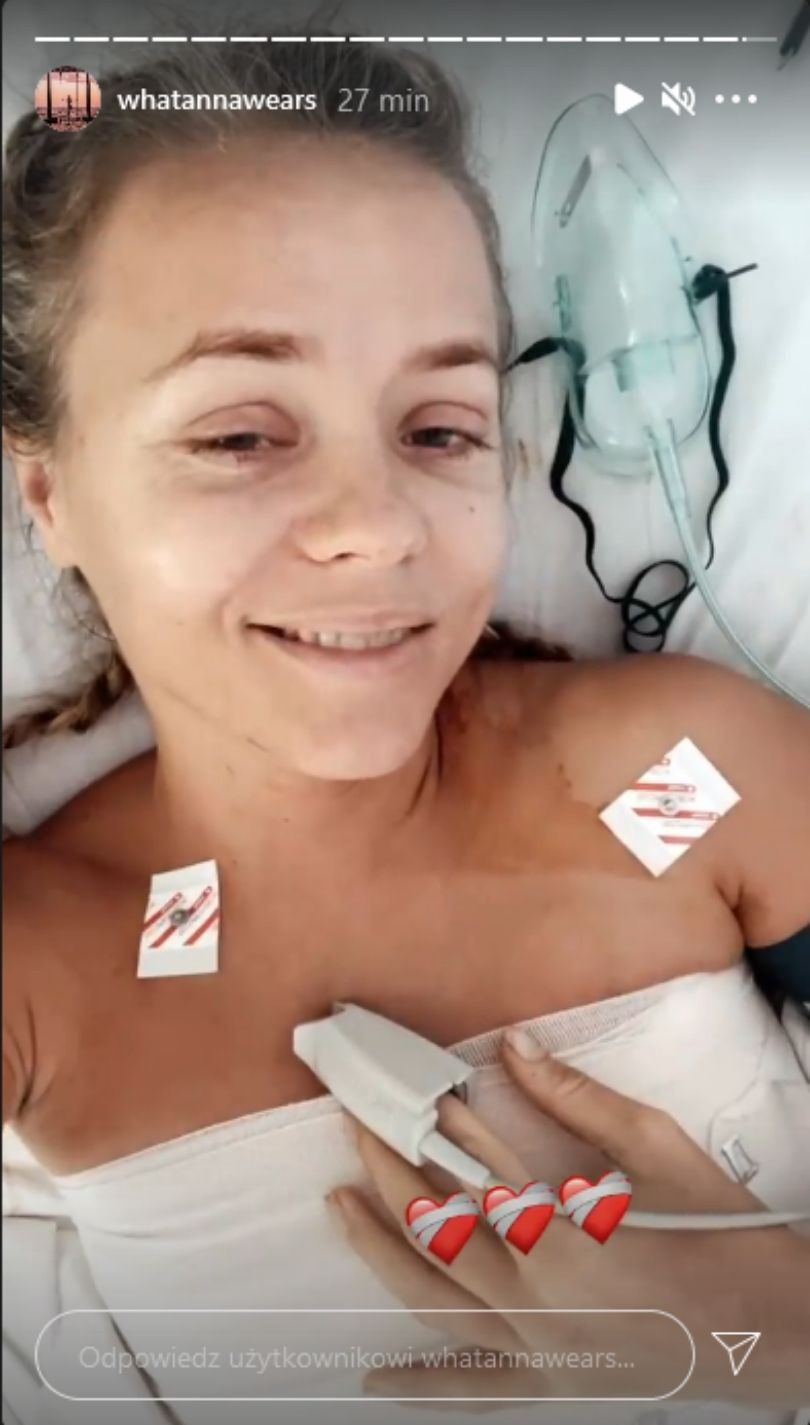 Anna Skura otwiera się na temat operacji