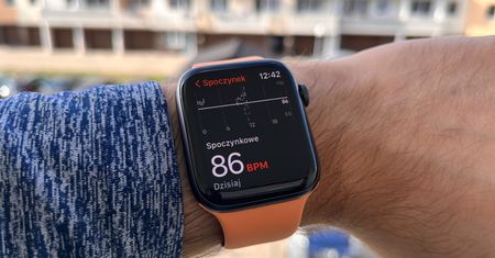 Apple Watch rzekomo wykrył ciążę. Jak to możliwe?