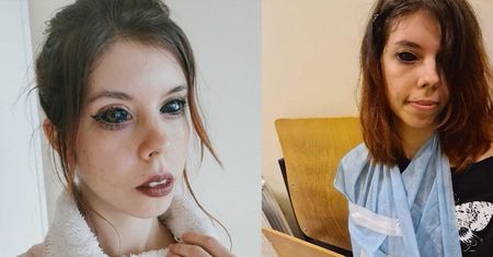"Fanka Popka" z wytatuowanymi gałkami ocznymi ZBIERA PIENIĄDZE na leczenie!