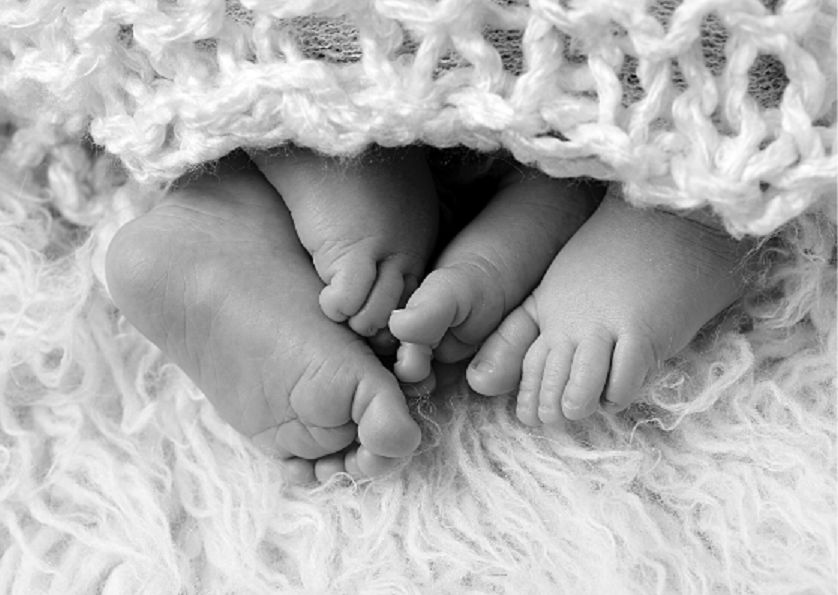 Nie żyją bliźnięta syjamskie z Gdańska