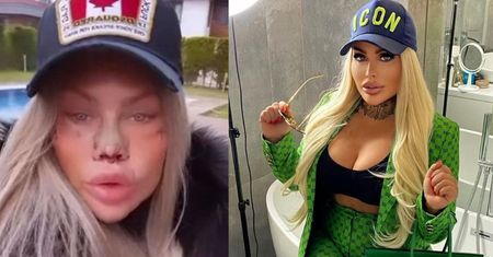 Laluna Unique radzi: "26 lat to dobry wiek, żeby coś sobie poprawić. Im później, tym lepiej"
