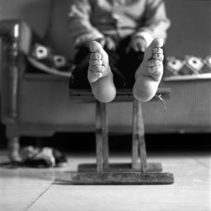 Operacje plastyczne. Kiedy powiemy „Stop!”?