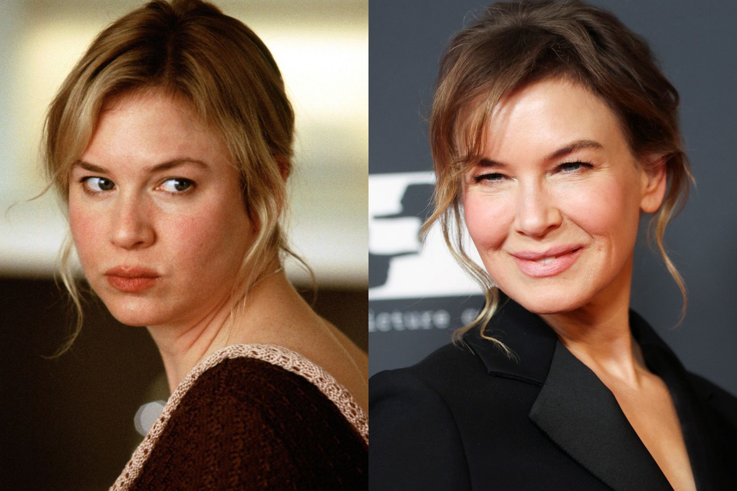 Renée Zellweger i medycyna estetyczna