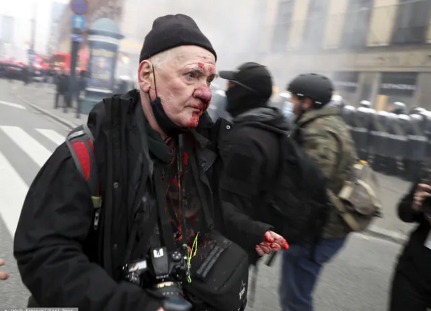 Tomasz Gutry został postrzelony przez policję. W piątek wyszedł ze szpitala