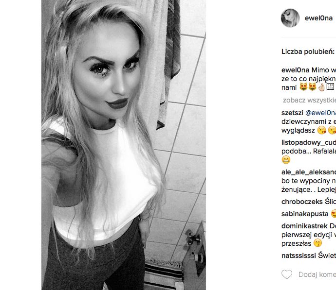 Ewelina z Warsaw Shore po operacji podbródka