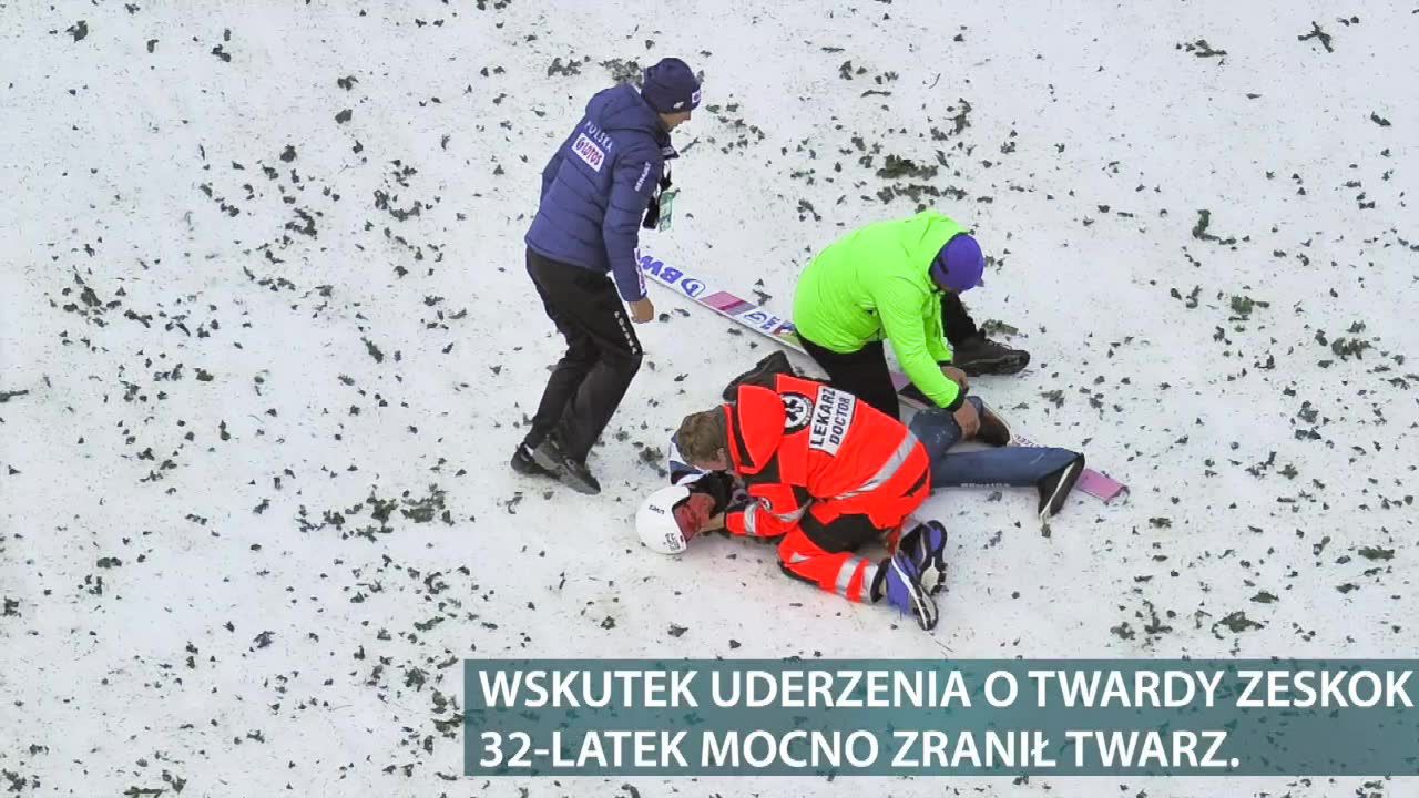 Piotr Żyła miał obdartą skórę na twarzy i zalał się krwią po groźnie wyglądającym upadku na skoczni w Wiśle.