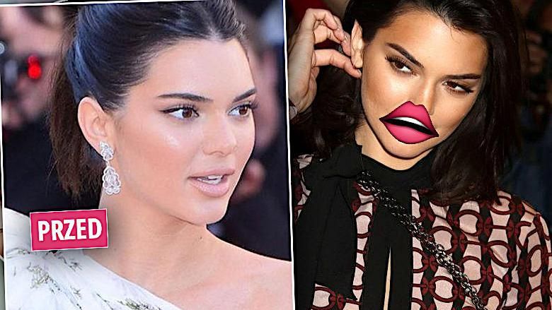 Kendall Jenner ma większe usta