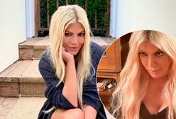 Tori Spelling będzie poprawiać sztuczny biust. Jej piersi to fuszerka