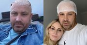 Walczący z nowotworem Adrian Szymaniak opowiada o wystąpieniu nowych objawów obrzęku mózgu: "Troszkę się WYSTRASZYŁEM"
