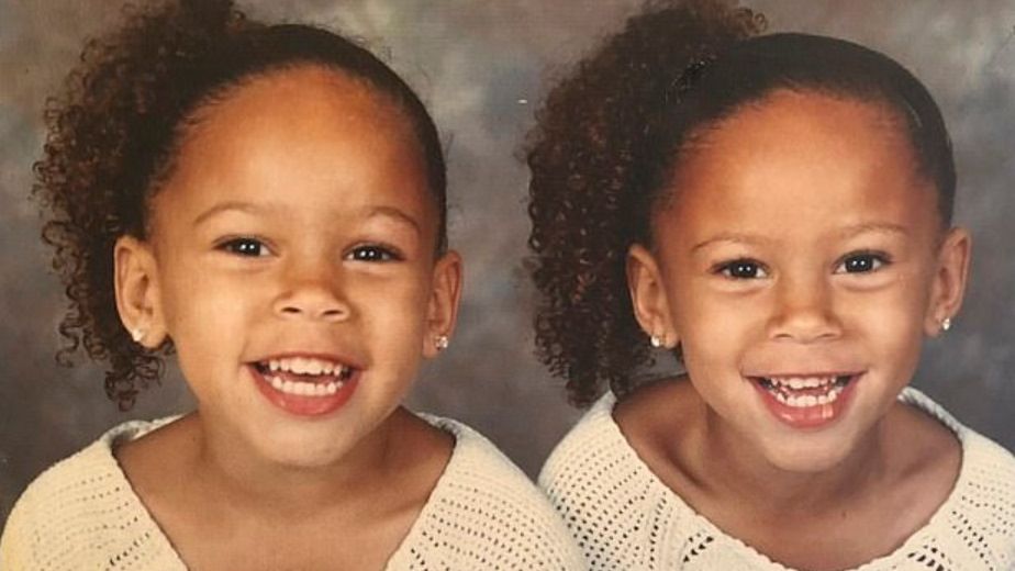 Urodziły się jako bliźnięta jednojajowe