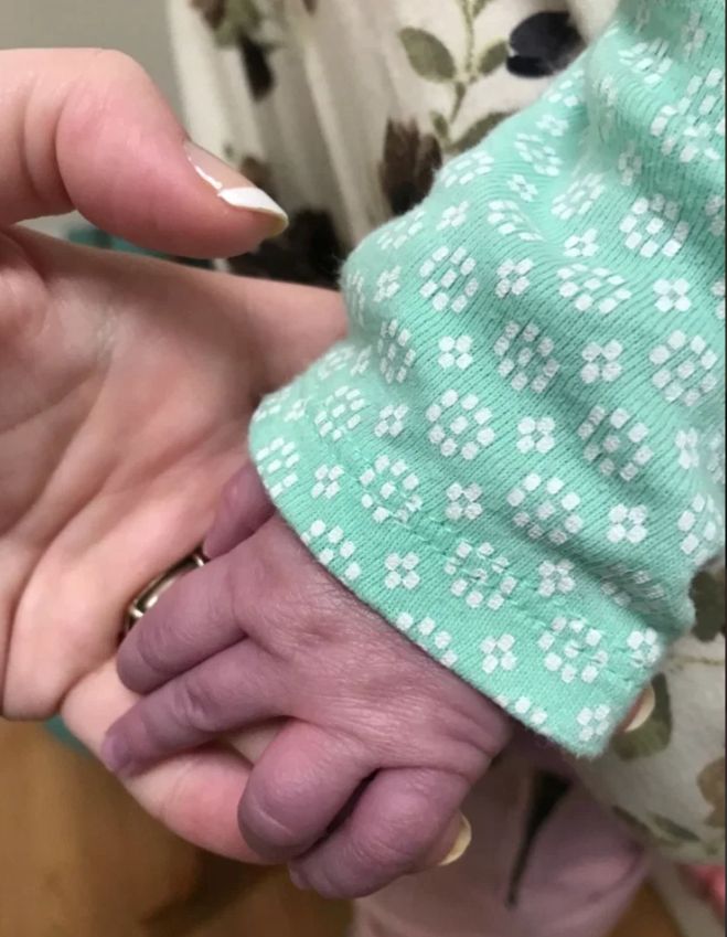 Dziewczynka mała fioletowe palce u rąk 