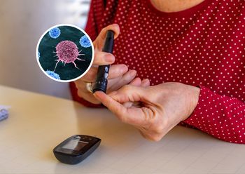 Insulinooporność a rak. Odkryto niepkojącą zależność