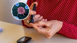 Insulinooporność a rak. Odkryto niepkojącą zależność