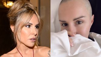 Blanka Lipińska tajemniczo zasłania twarz i ogłasza, że zafundowała sobie KOLEJNE POPRAWKI. "Zabieg się udał"