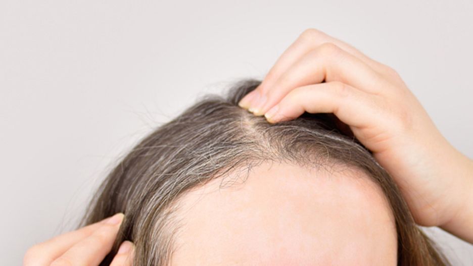 Siwe włosy u dzieci i nastolatków. "To alarmujące zjawisko"