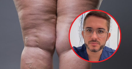 "Nie daj sobie wmówić, że taka twoja uroda". Znany lekarz ostrzega