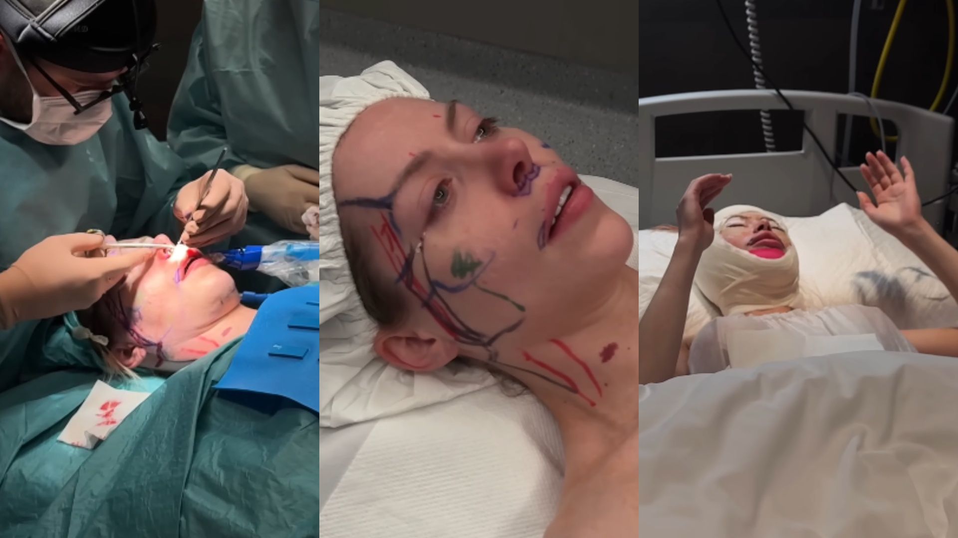 Julia von Stein podczas operacji plastycznej