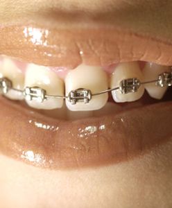 Kradł miedziane kable, żeby mieć na aparat na zęby