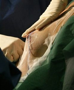 Internauci sponsorują powiększenie biustu