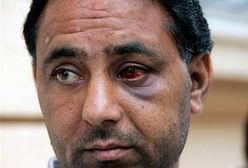 Wzrasta przemoc na tle rasowym w Unii Europejskiej