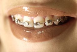 Kradł miedziane kable, żeby mieć na aparat na zęby